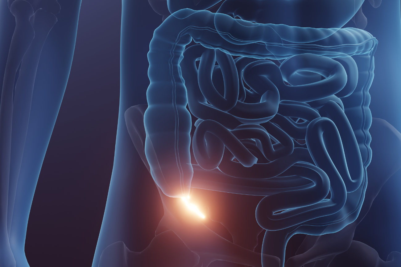3d illustration of Appendix